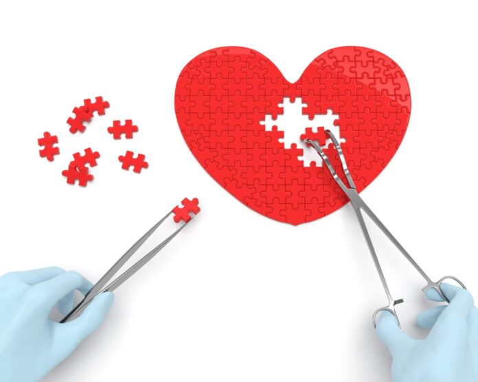 Cardiac Surgery_Julius Berger_FMC Abuja